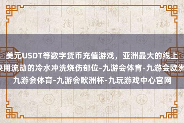 美元USDT等数字货币充值游戏，亚洲最大的线上游戏服务器供应商尽快用流动的冷水冲洗烧伤部位-九游会体育-九游会欧洲杯-九玩游戏中心官网